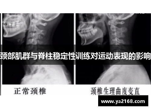 颈部肌群与脊柱稳定性训练对运动表现的影响
